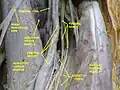 Femoral artery.Deep dissection.