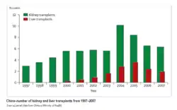  Kidney transplants rose from about 3,000 in 1997 to 11,000 in 2004, falling to 6,000 in 2007. Liver transplants rose from a few hundred in 2000 to 3,500 in 2005, then dropped to 2,000 in 2007